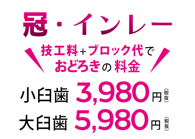 ＣＡＤ/ＣＡＭ冠材料代込特別価格　小臼歯3980円(税別)　大臼歯5980円(税別)
